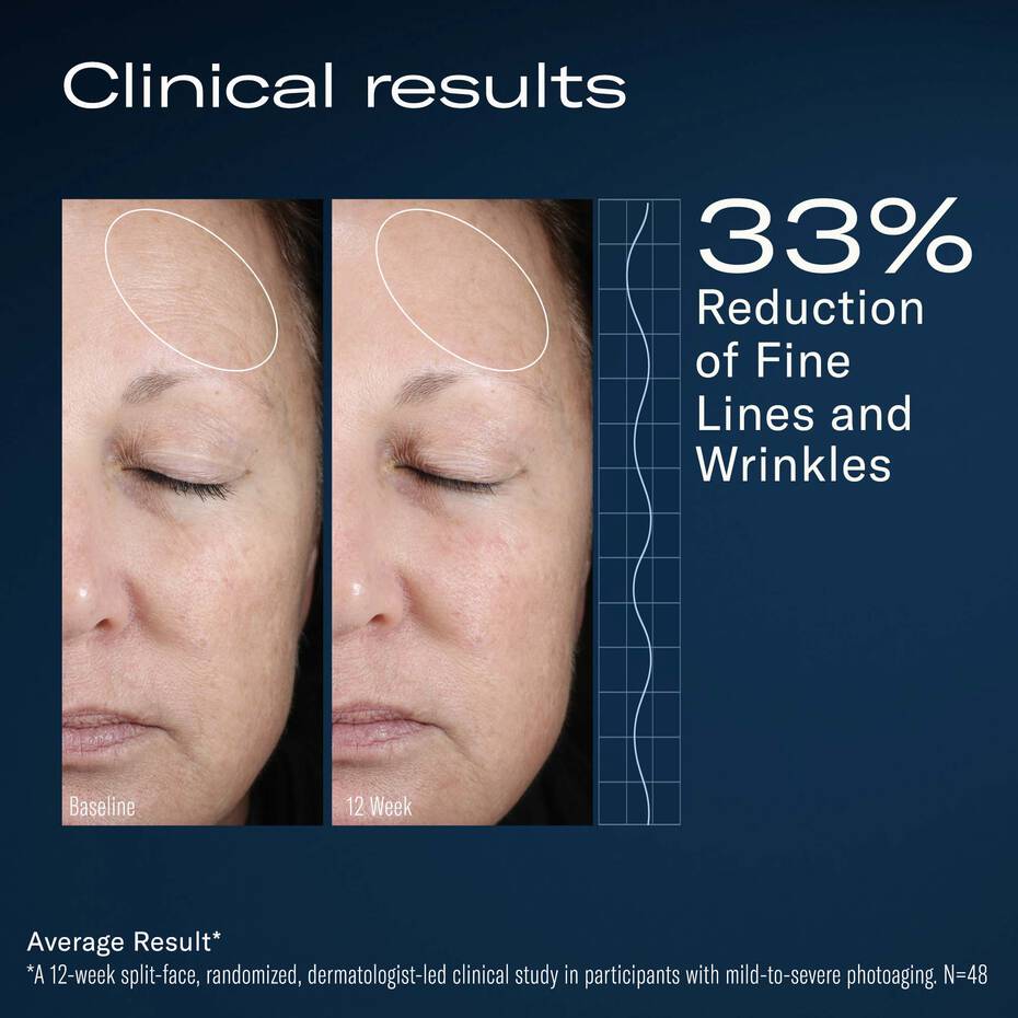 AlphaRet Overnight Cream