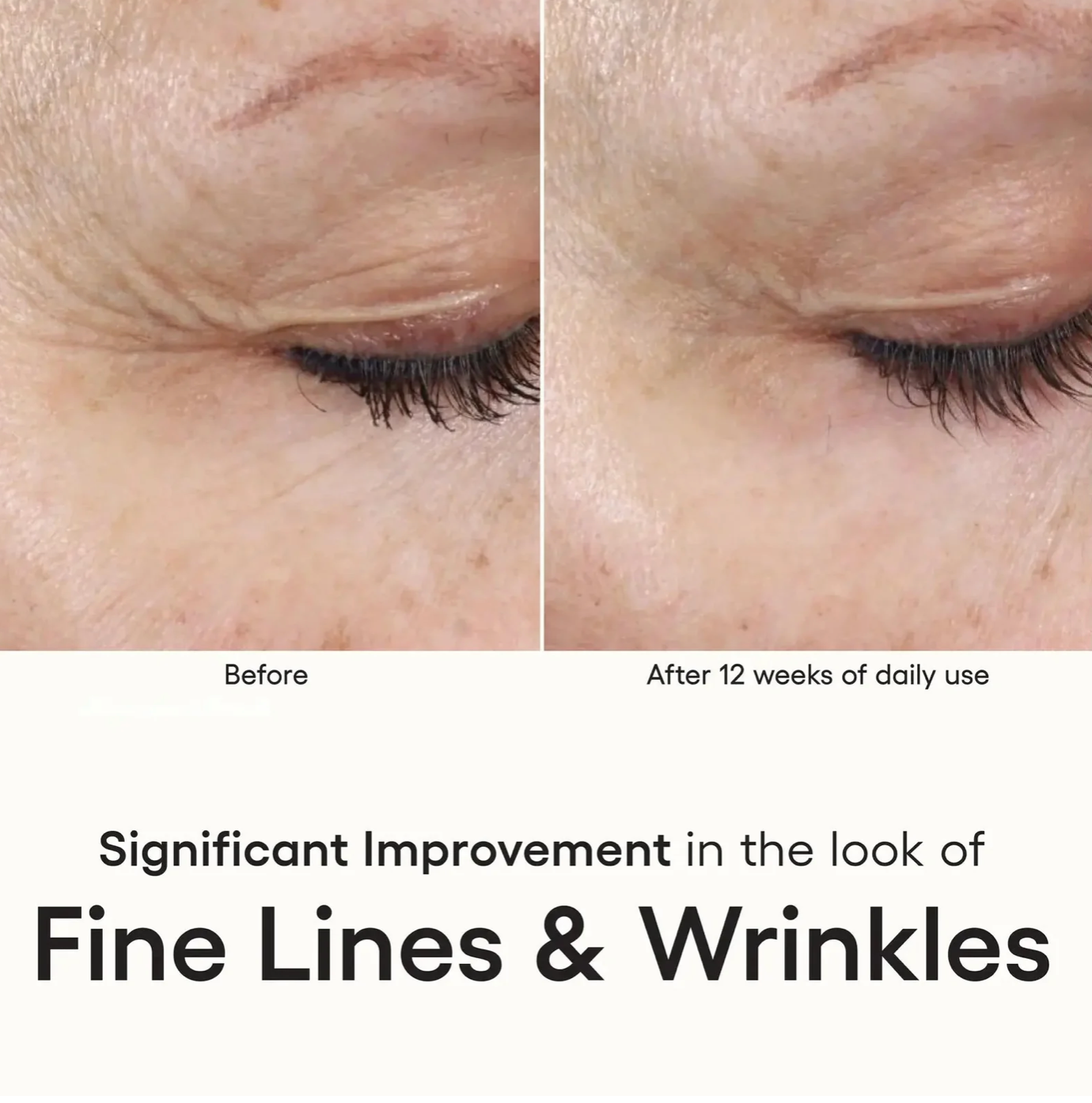 INTENSE Serum