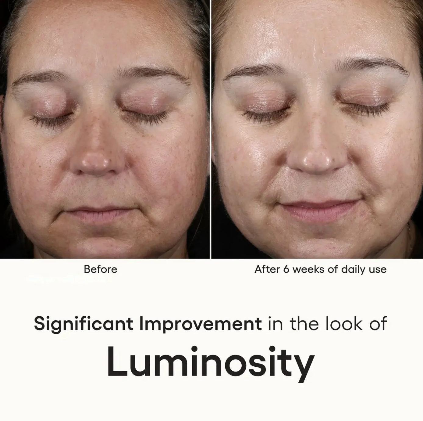INTENSE Serum