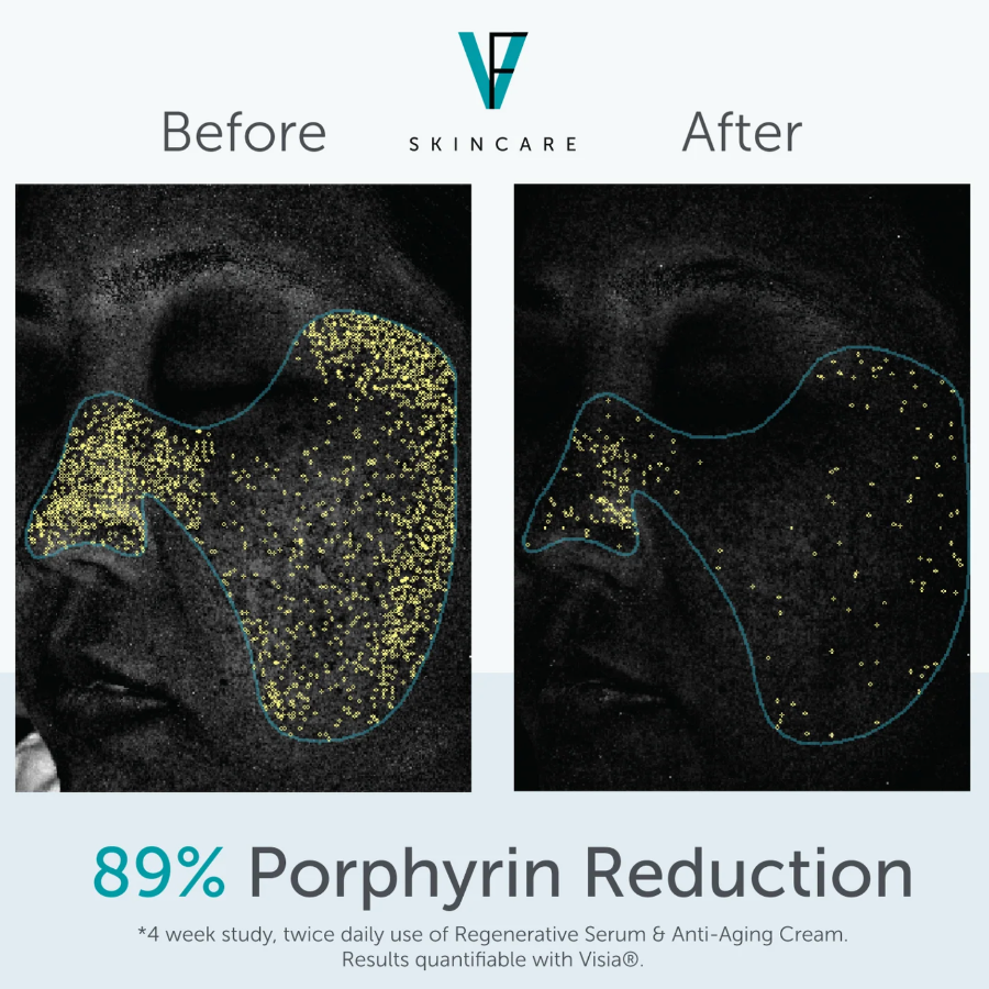 REGENERATIVE SERUM