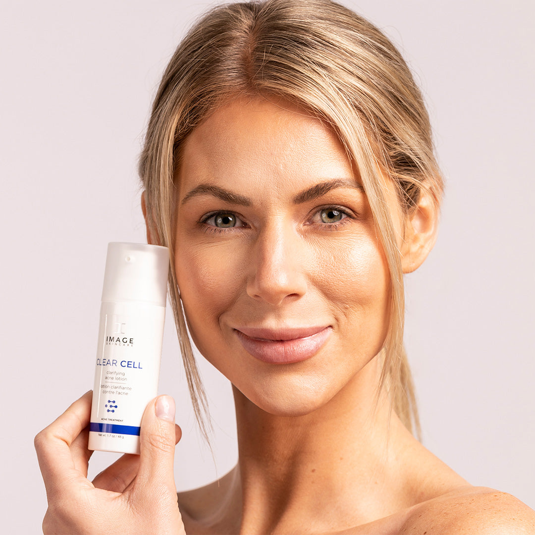 Clear Cell Clarifying Acne Lotion