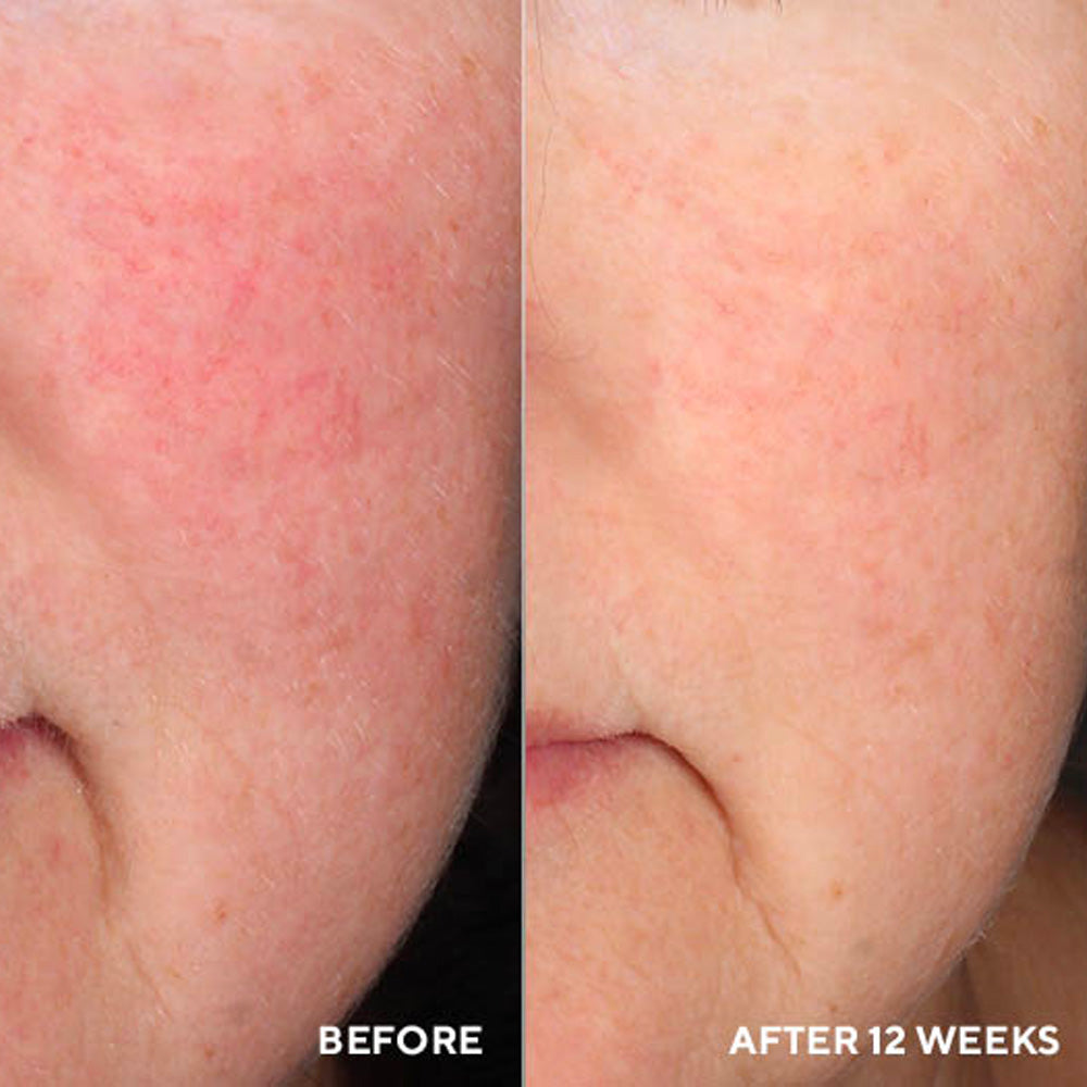 InnerDerm Rx