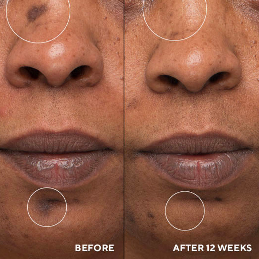 InnerDerm Rx