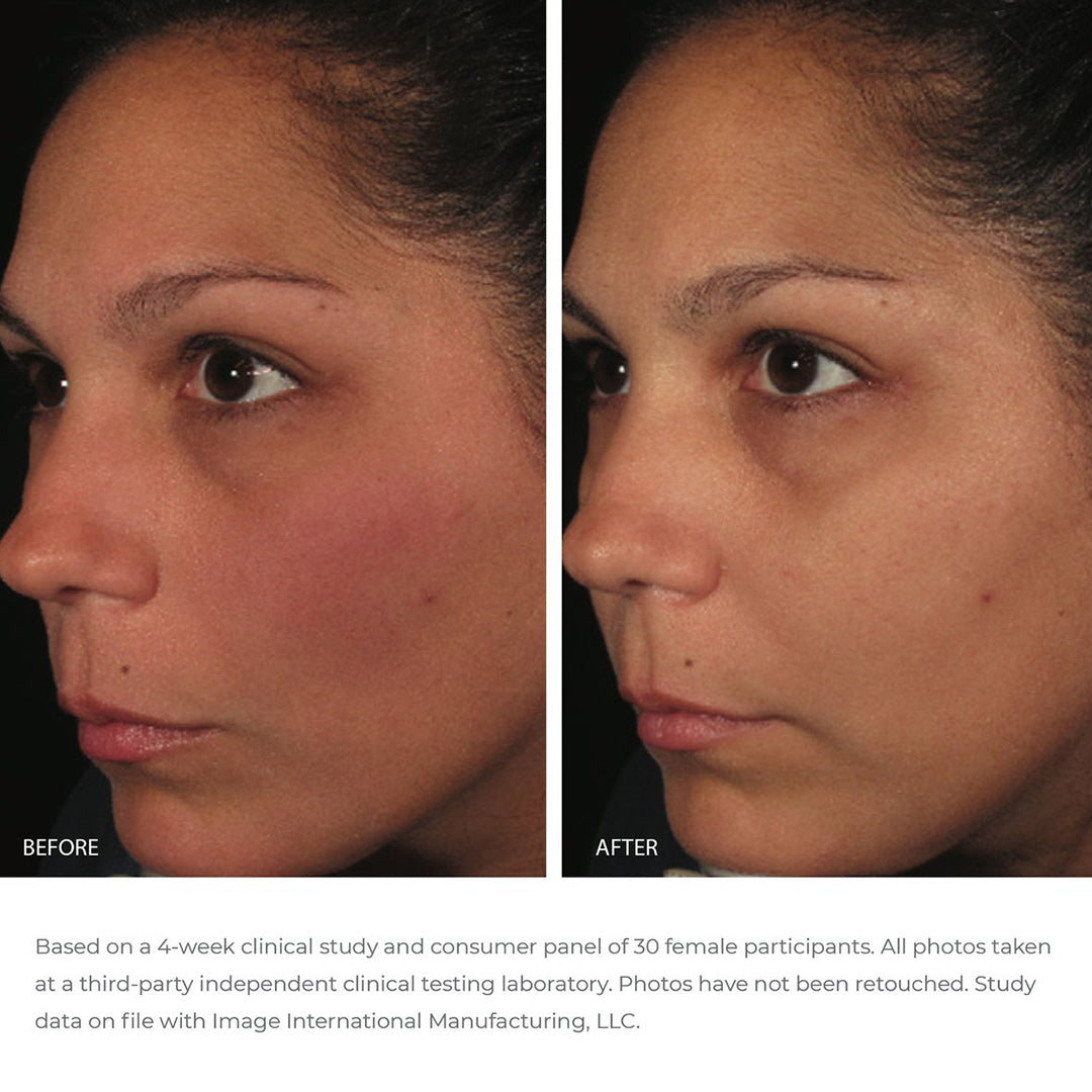 ORMEDIC Antioxidant Serum