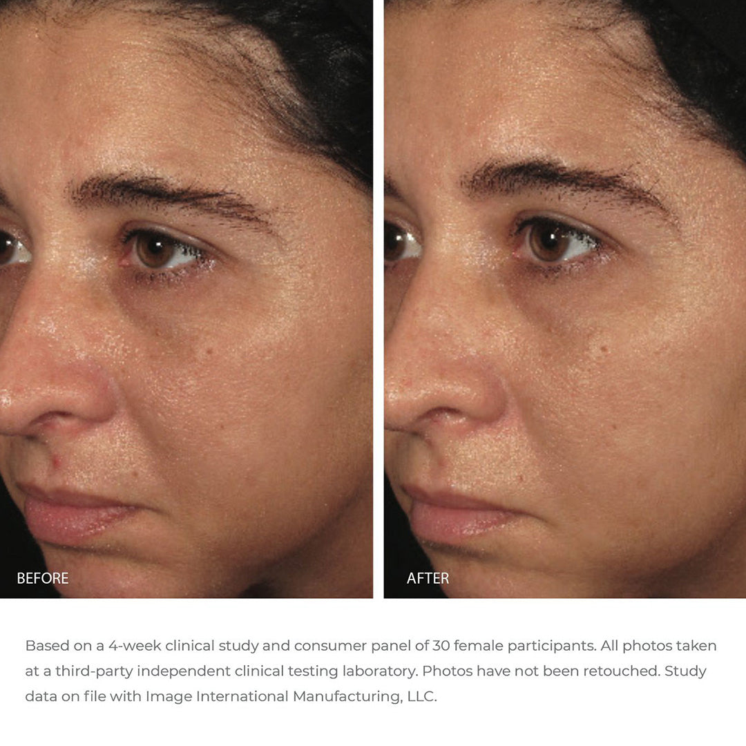 ORMEDIC Balancing Biopeptide Crème