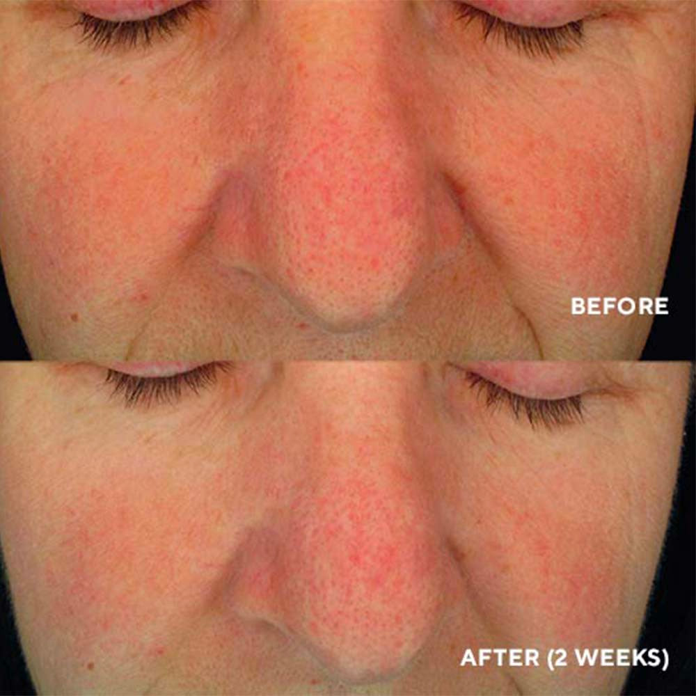 Soothing Serum