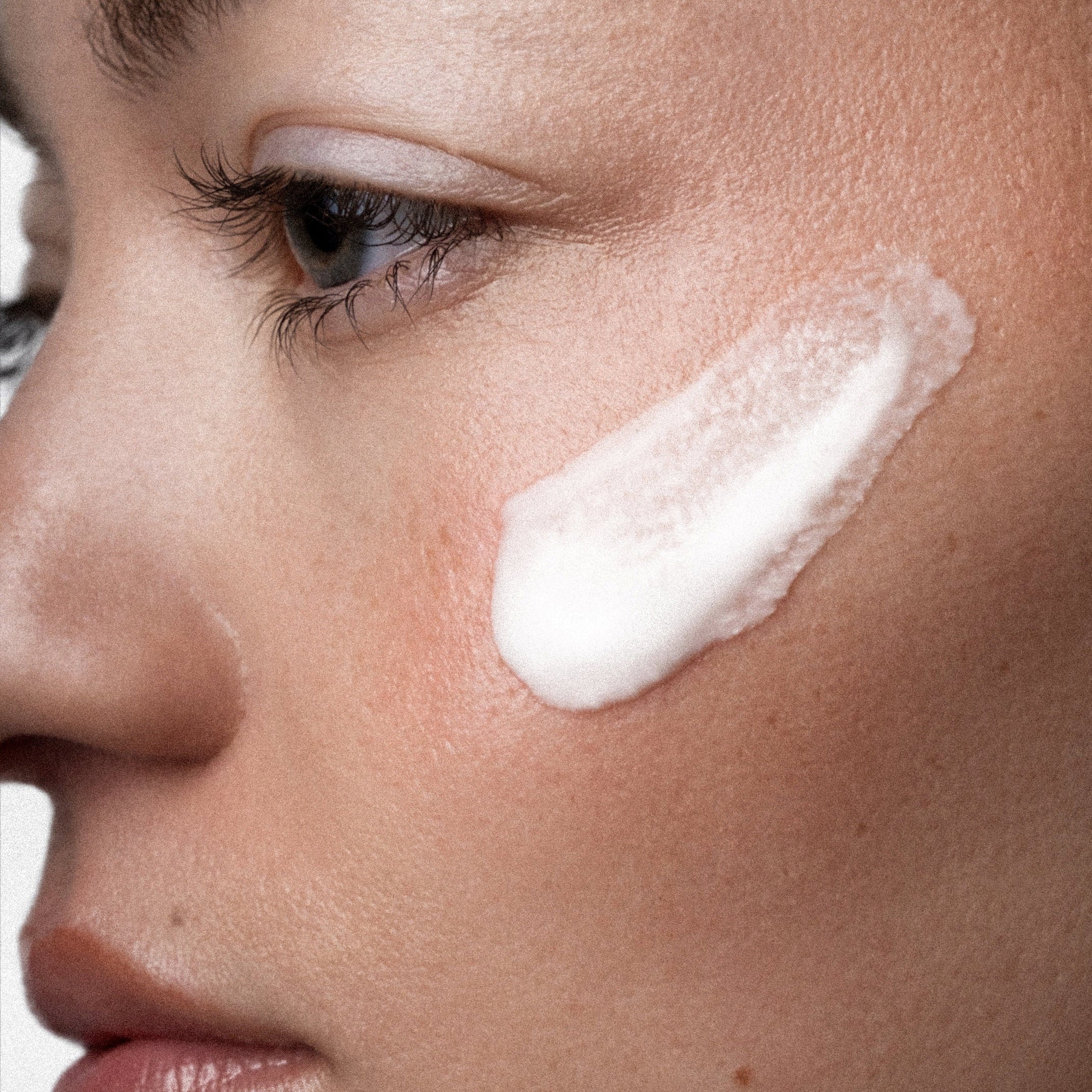 ÂN-DEW 10% Azelaic Acid + PHA Serum