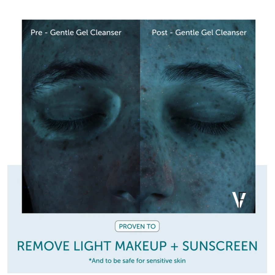 GENTLE GEL FACIAL CLEANSER