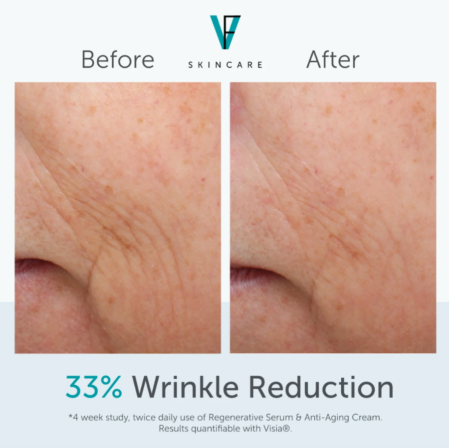 ANTI-AGING CREAM