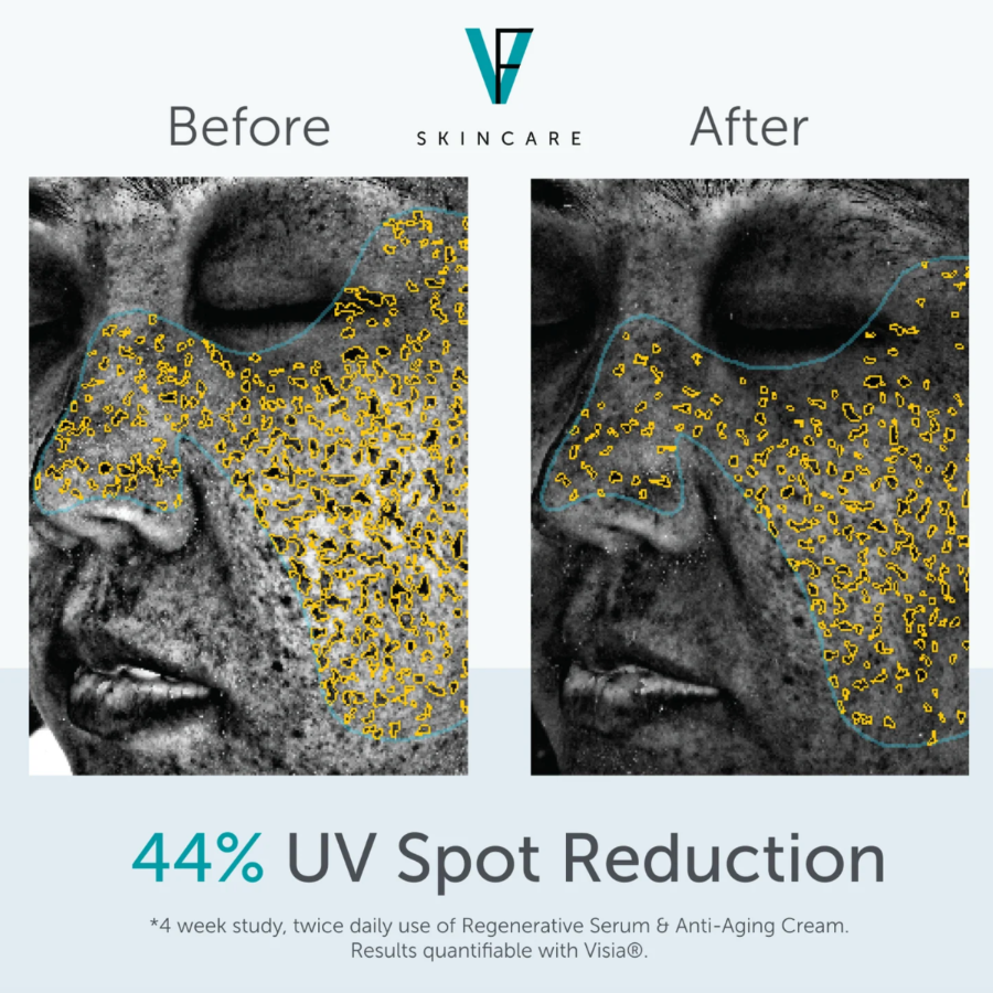 ANTI-AGING CREAM