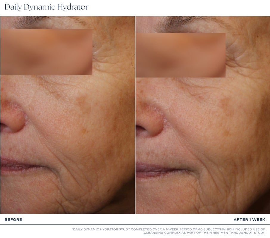 Daily Dynamic Hydrator